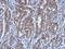 Ubiquitination Factor E4A antibody, GTX110889, GeneTex, Immunohistochemistry paraffin image 
