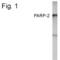 PARP2 antibody, PA1-4280, Invitrogen Antibodies, Western Blot image 