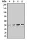 Trimethyllysine Hydroxylase, Epsilon antibody, orb412582, Biorbyt, Western Blot image 