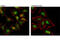 Nuclear Receptor Subfamily 3 Group C Member 1 antibody, 12007S, Cell Signaling Technology, Immunofluorescence image 