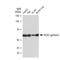 Cytochrome B-245 Beta Chain antibody, GTX01533, GeneTex, Western Blot image 