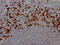 Myeloperoxidase antibody, CSB-RA617176A0HU, Cusabio, Immunohistochemistry paraffin image 
