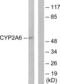Cytochrome P450 2A6 antibody, LS-C119493, Lifespan Biosciences, Western Blot image 