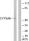 Cytochrome P450 Family 2 Subfamily A Member 6 antibody, LS-C119493, Lifespan Biosciences, Western Blot image 