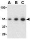 Poly(RC) Binding Protein 4 antibody, GTX31272, GeneTex, Western Blot image 