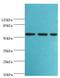 Aladin WD Repeat Nucleoporin antibody, LS-C379747, Lifespan Biosciences, Western Blot image 