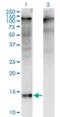 Zinc Finger And BTB Domain Containing 16 antibody, H00007704-M01, Novus Biologicals, Western Blot image 
