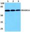 Ubiquitin Associated And SH3 Domain Containing A antibody, A10433, Boster Biological Technology, Western Blot image 