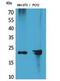 HDGF Like 3 antibody, A12283-1, Boster Biological Technology, Western Blot image 