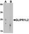 GLIPR1 Like 2 antibody, TA326700, Origene, Western Blot image 