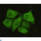 Protein Phosphatase 1 Catalytic Subunit Alpha antibody, LS-C813094, Lifespan Biosciences, Immunocytochemistry image 
