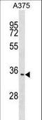 Integral Membrane Protein 2C antibody, LS-C159944, Lifespan Biosciences, Western Blot image 