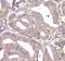 Adenine Phosphoribosyltransferase antibody, A02721-3, Boster Biological Technology, Immunohistochemistry paraffin image 