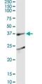 SH3 Domain Containing GRB2 Like 1, Endophilin A2 antibody, H00006455-M05, Novus Biologicals, Western Blot image 