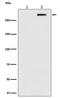 ATM Serine/Threonine Kinase antibody, P00014-1, Boster Biological Technology, Western Blot image 