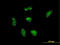 Ribosomal Protein L21 antibody, LS-C198111, Lifespan Biosciences, Immunofluorescence image 