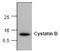 Cystatin B antibody, AM00189PU-N, Origene, Western Blot image 