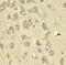 I10R1 antibody, FNab04213, FineTest, Immunohistochemistry paraffin image 