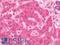 Alpha Kinase 2 antibody, LS-B11717, Lifespan Biosciences, Immunohistochemistry frozen image 