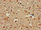 ALX Homeobox 1 antibody, CSB-PA624031LA01HU, Cusabio, Immunohistochemistry frozen image 