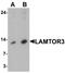 Late Endosomal/Lysosomal Adaptor, MAPK And MTOR Activator 3 antibody, A08040, Boster Biological Technology, Western Blot image 