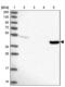 Transmembrane Protein 44 antibody, NBP1-90507, Novus Biologicals, Western Blot image 