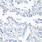 Multidrug resistance protein 1 antibody, 14-133, ProSci, Immunohistochemistry frozen image 