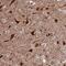 Pregnancy Specific Beta-1-Glycoprotein 11 antibody, PA5-61228, Invitrogen Antibodies, Immunohistochemistry frozen image 