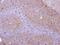 Protein Phosphatase 6 Catalytic Subunit antibody, NBP2-19918, Novus Biologicals, Immunohistochemistry paraffin image 