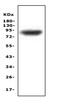 Mitogen-Activated Protein Kinase Kinase Kinase 20 antibody, A00902-1, Boster Biological Technology, Western Blot image 