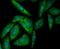 Syndecan Binding Protein antibody, NBP2-76873, Novus Biologicals, Immunocytochemistry image 