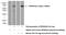 Ribosomal Protein S6 Kinase A5 antibody, 15977-1-AP, Proteintech Group, Western Blot image 