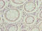 Mitochondrial Ribosomal Protein L14 antibody, LS-C396809, Lifespan Biosciences, Immunohistochemistry paraffin image 