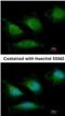 POLG antibody, NBP1-33633, Novus Biologicals, Immunocytochemistry image 
