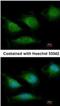 DNA Polymerase Gamma, Catalytic Subunit antibody, NBP1-33633, Novus Biologicals, Immunocytochemistry image 