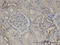 Calmodulin Like 5 antibody, LS-C134076, Lifespan Biosciences, Immunohistochemistry paraffin image 