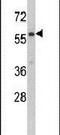 Cysteinyl-TRNA Synthetase 2, Mitochondrial antibody, PA5-14999, Invitrogen Antibodies, Western Blot image 