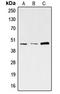 S-Phase Kinase Associated Protein 2 antibody, LS-C352844, Lifespan Biosciences, Western Blot image 