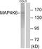 MINK1 antibody, A30524, Boster Biological Technology, Western Blot image 
