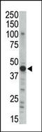 Protein Kinase CAMP-Dependent Type II Regulatory Subunit Beta antibody, MBS9211494, MyBioSource, Western Blot image 