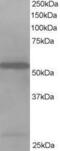 Drebrin Like antibody, GTX89787, GeneTex, Western Blot image 