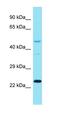 Inhibitory Synaptic Factor 1 antibody, orb326922, Biorbyt, Western Blot image 