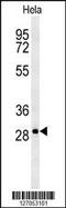 Transmembrane Protein 165 antibody, 61-958, ProSci, Western Blot image 