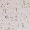 Oligophrenin 1 antibody, PA5-51775, Invitrogen Antibodies, Immunohistochemistry paraffin image 