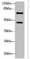 Transmembrane 9 Superfamily Member 1 antibody, LS-C676600, Lifespan Biosciences, Western Blot image 