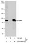 G Protein-Coupled Receptor Kinase 2 antibody, PA5-77852, Invitrogen Antibodies, Immunoprecipitation image 