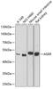 RAGE antibody, GTX55773, GeneTex, Western Blot image 