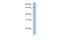 Acsl2 antibody, GTX47781, GeneTex, Western Blot image 