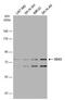 DEAD-Box Helicase 3 X-Linked antibody, GTX110614, GeneTex, Western Blot image 