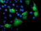 Katanin Regulatory Subunit B1 antibody, TA503780, Origene, Immunofluorescence image 